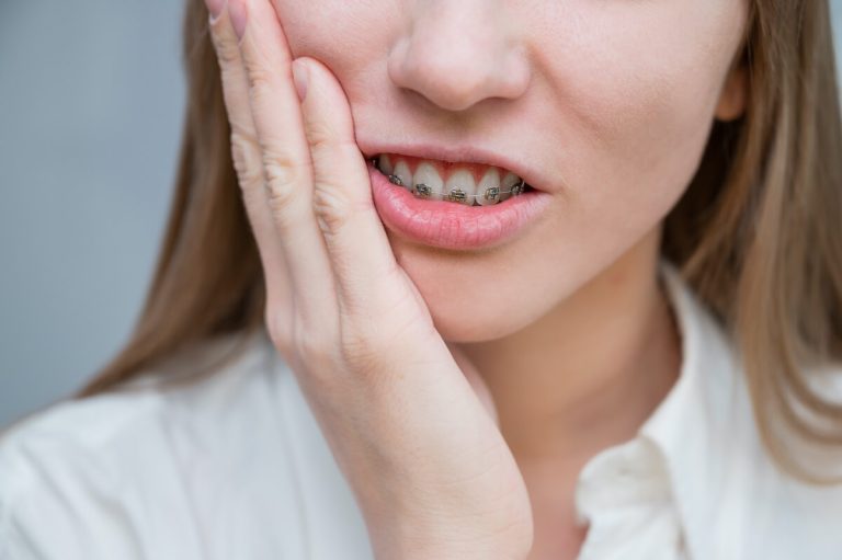 What Does It Mean When You Dream of Braces
