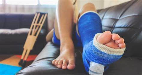 What Does It Mean When You Dream of Broken Leg