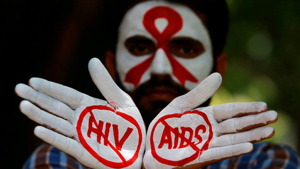 What Does It Mean When You Dreaming of AIDS