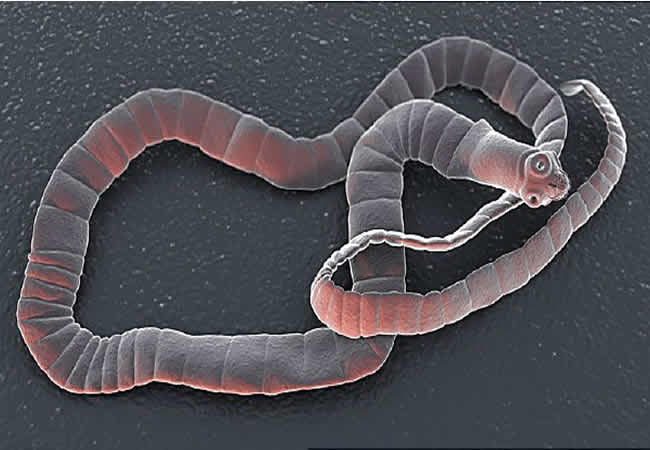 What does it mean to dream about tapeworms?